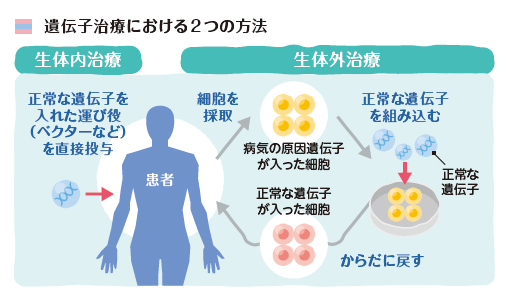 遺伝子治療における2つの方法