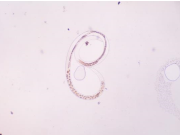 顕微鏡で観察したプランクトンの一例